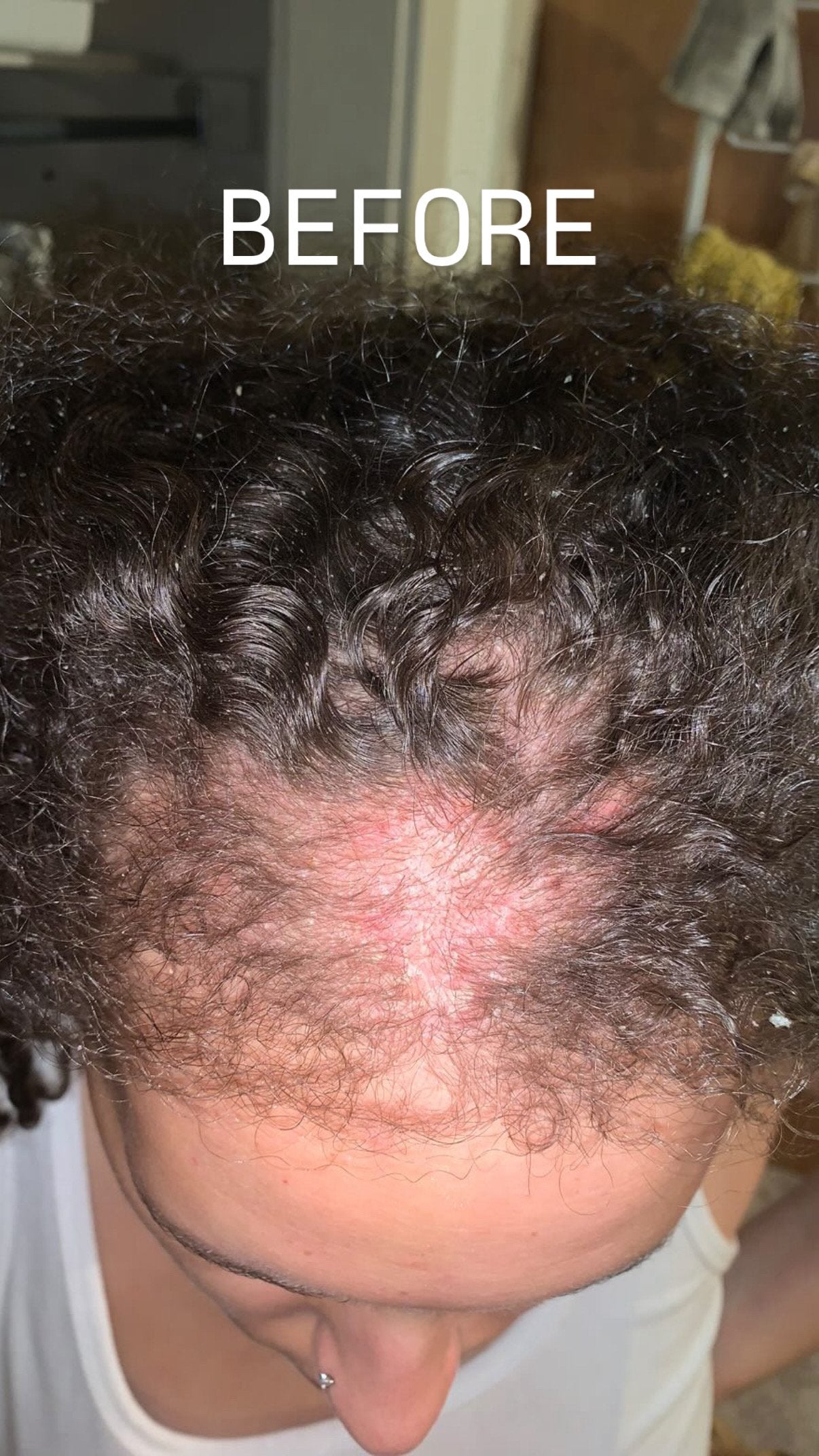 Herbal Hair + Scalp Remedy Oil